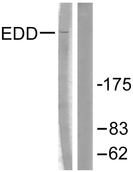 IHC-plus™ Polyclonal Rabbit anti-Human UBR5 Antibody (aa1-50, IHC, WB)