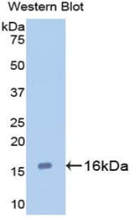 LGALS7 / Galectin 7 Antibody (aa1-136)