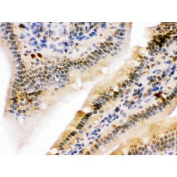 NIRF / UHRF2 Antibody (aa15-54)