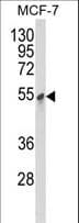 PDK3 Antibody