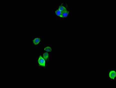 Polyclonal Rabbit anti-Human ANP32D Antibody (IHC, IF)