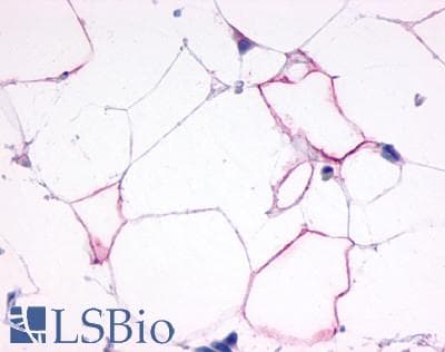 PathPlus™ GCGR / Glucagon Receptor Antibody (N-Terminus)