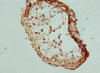Polyclonal Rabbit anti-Human CCP110 Antibody (IHC, WB)
