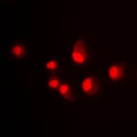 MDM2 Antibody (C-Terminus)