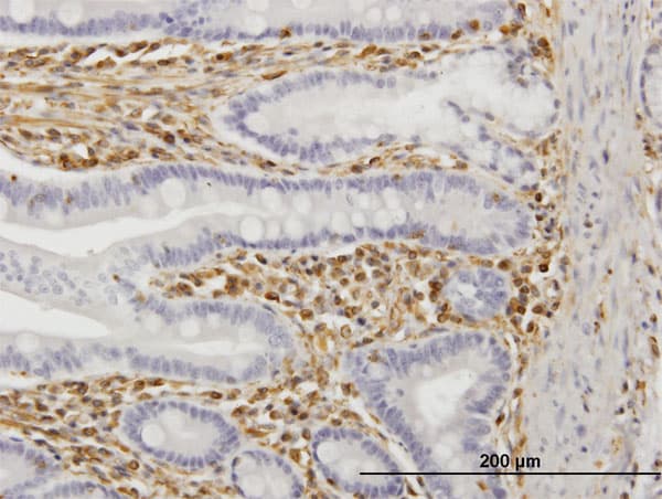 TRIM16 Antibody (clone 5G11)