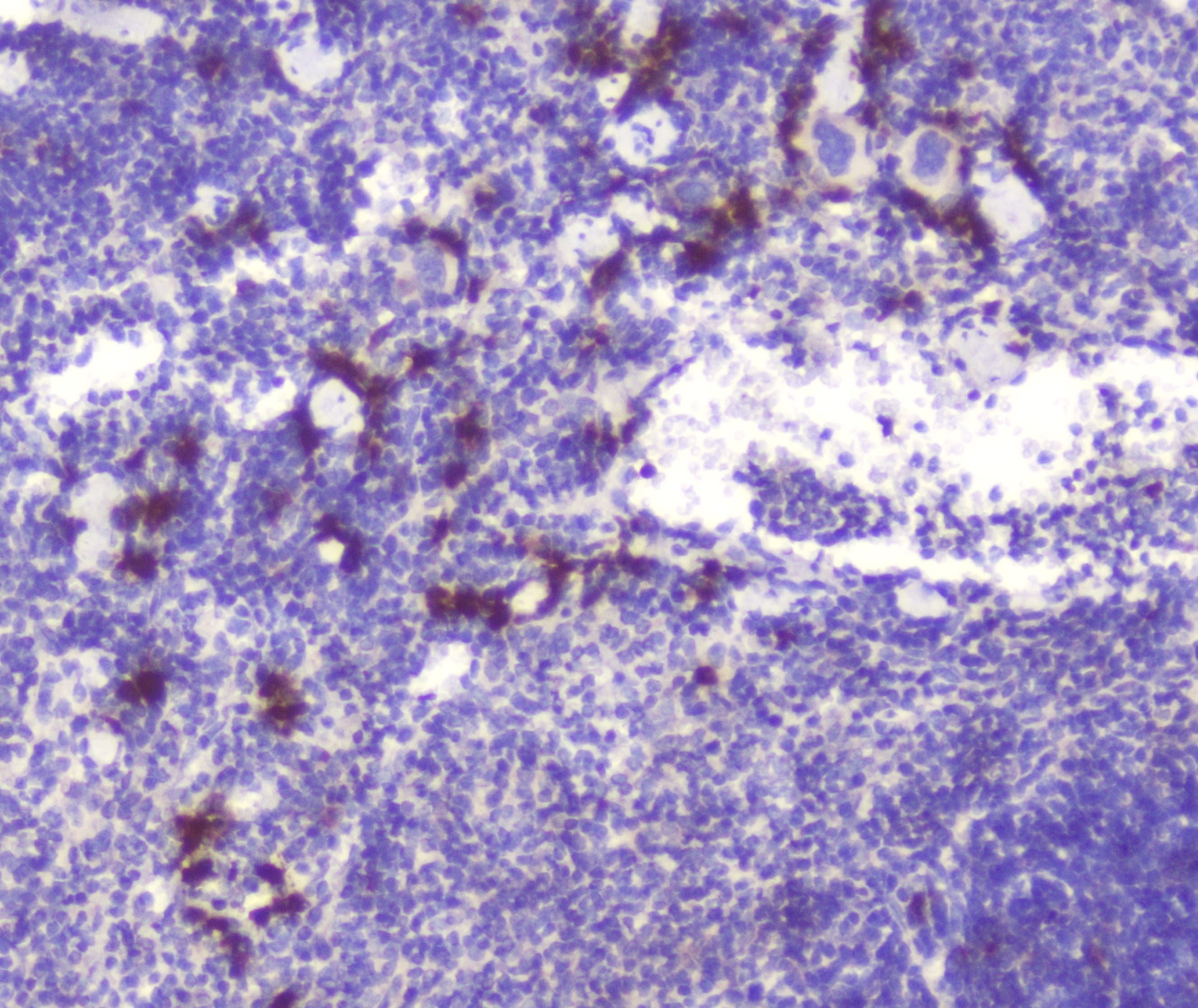 RASAL1 / RASAL Antibody