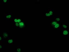 Monoclonal Mouse anti-Human TP53 / p53 Antibody (clone OTI3D5, IHC, IF, WB)