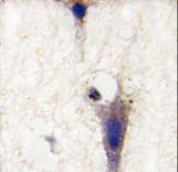 Polyclonal Rabbit anti-Human LINGO1 Antibody (aa62-92, IHC, WB)