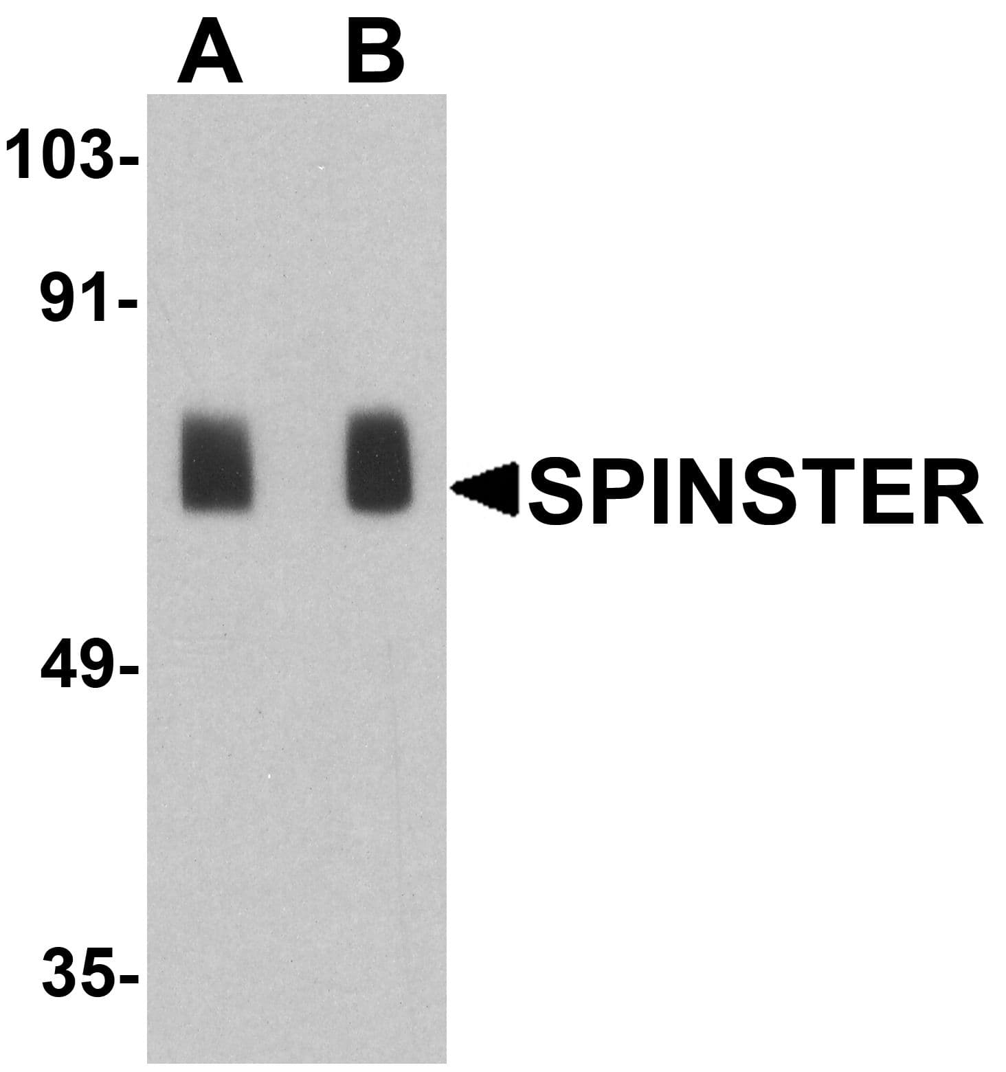 SPNS1 / Spinster Antibody