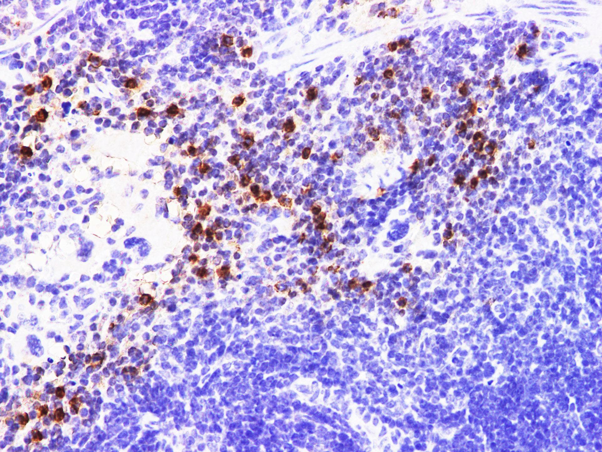 S100A9 / MRP14 Antibody