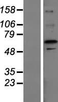 ZFP64 Protein (Over-Expression Lysate Myc-DDK (Flag))