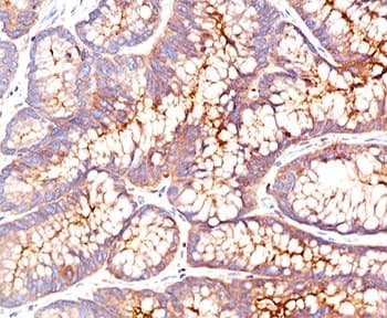 Monoclonal Mouse anti-Human CEA / Carcinoembryonic Antigen Antibody (clone CEA31, Azide-free,BSA-free, IHC, IF, WB)