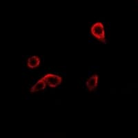 R1 / RRM1 Antibody