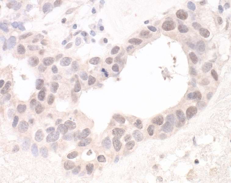 HUWE1 / ARFBP1 Antibody (aa2250-2300)