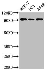 Polyclonal Rabbit anti-Human AMPD1 Antibody (WB)