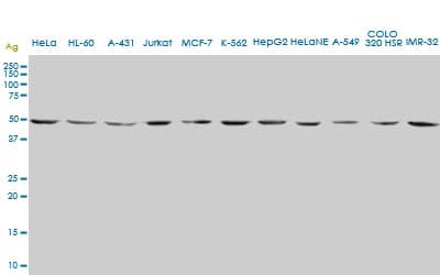ENO2 / NSE Antibody (clone 1A3)