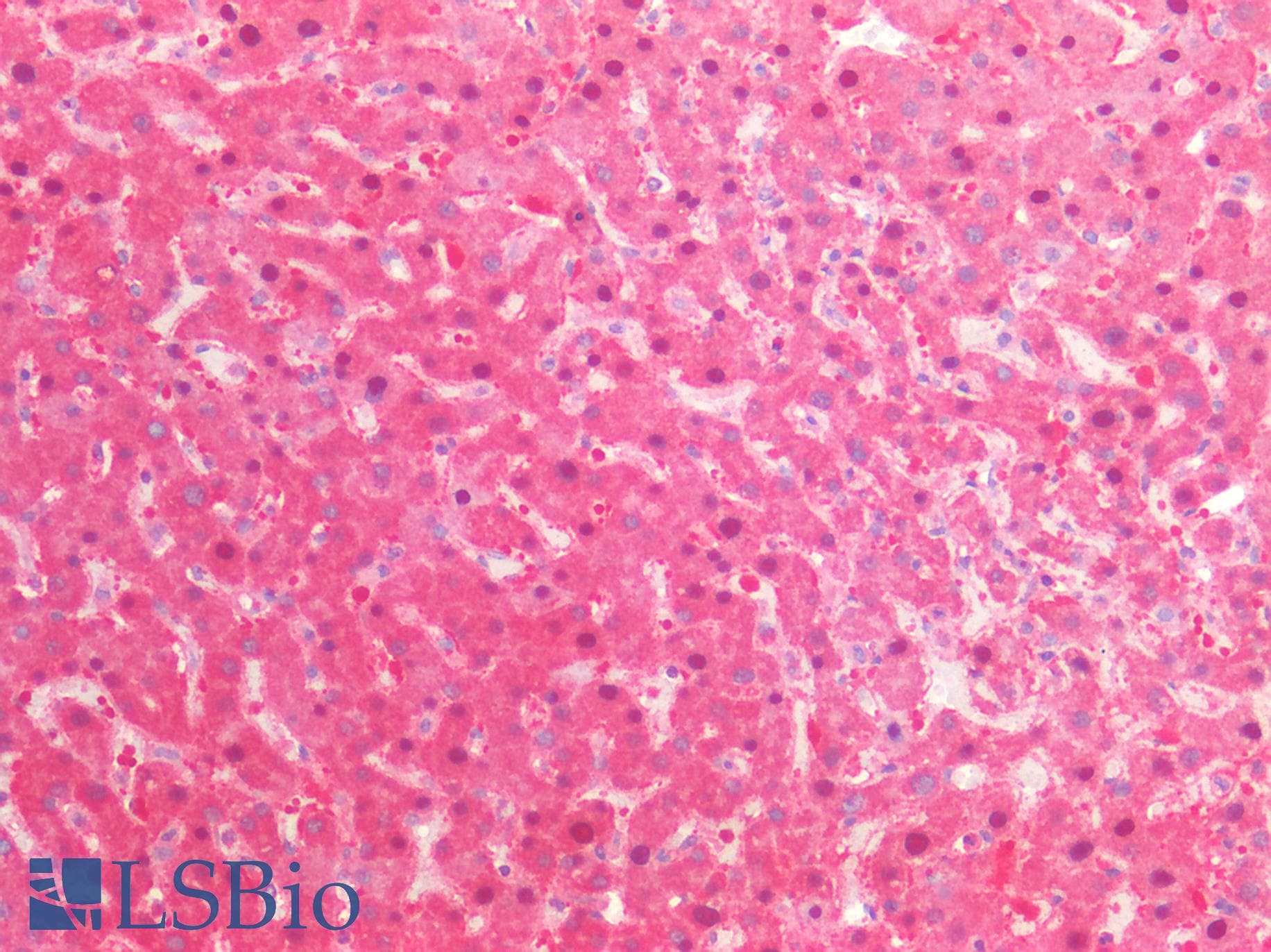 IHC-plus™ QPRT Antibody (clone AT24C4)