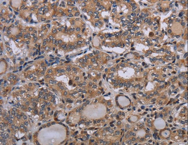 Polyclonal Rabbit anti-Human P2RX2 / P2X2 Antibody (IHC, WB)