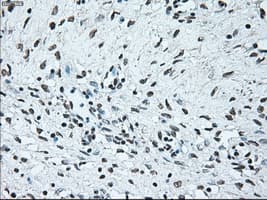 BRAF / B-Raf Antibody (clone OTI4C5)