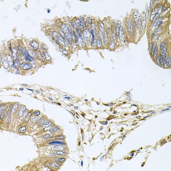 STRN3 Antibody
