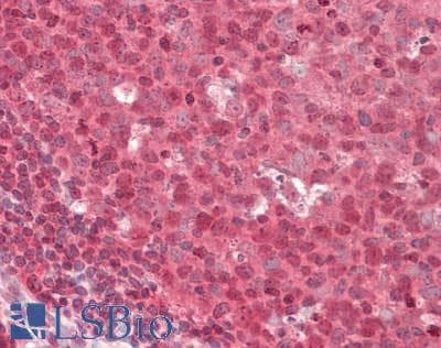 IHC-plus™ ABCG8 Antibody