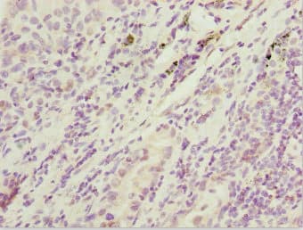 SIK3 / QSK Antibody