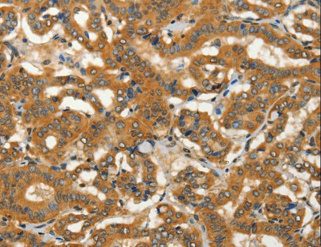 ADCY3 / Adenylate Cyclase 3 Antibody (aa855-1144)