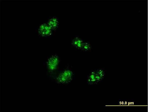 Treacle / TCOF1 Antibody (clone 8H3)