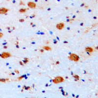 Polyclonal Rabbit anti-Human ARHGAP22 / RhoGAP2 Antibody (C-Terminus, IHC, WB)