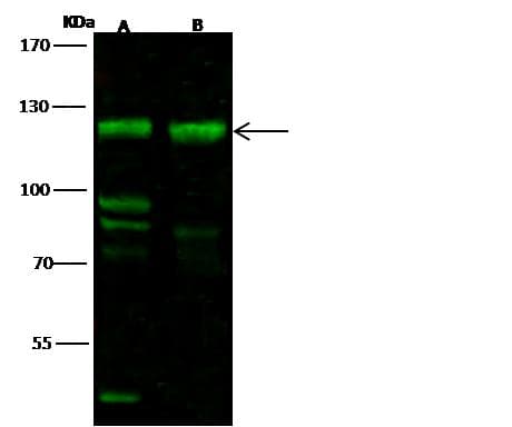 FBXO11 Antibody (Preservative Free)