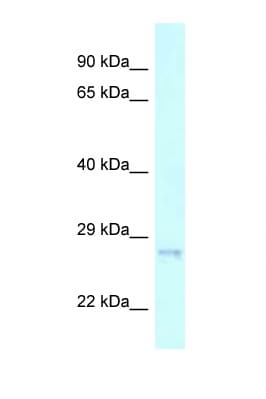 CHMP2A Antibody (C-Terminus)