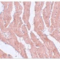 Polyclonal Rabbit anti-Human LZTR1 Antibody (IHC, WB)