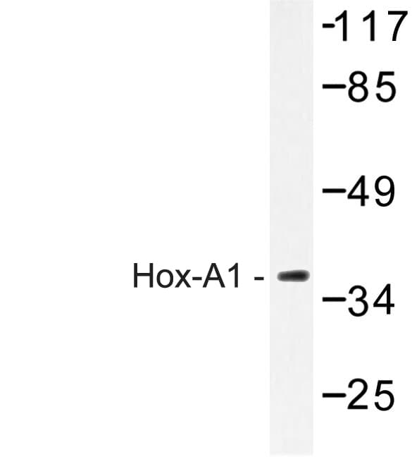 Polyclonal Rabbit anti-Human HOXA1 Antibody (Gln203, IHC, WB)