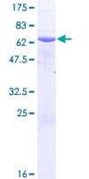 Human AGA / Aspartylglucosaminidase Protein (Recombinant GST)