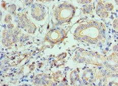 CCL28 / MEC Antibody (aa20-127)