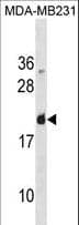 LGALS7 / Galectin 7 Antibody (aa54-82)