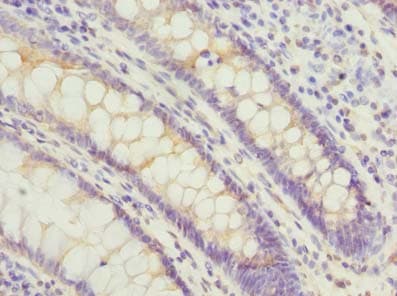 PSG3 Antibody