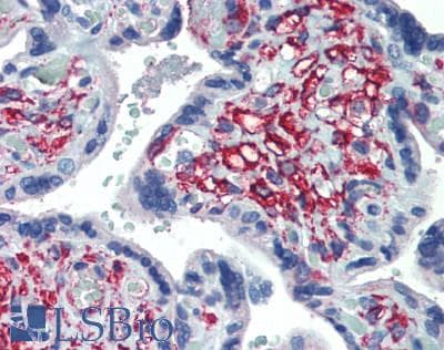 DLK1 / Pref-1 Antibody (aa177-326)