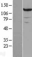 PC / Pyruvate Carboxylase Protein (Over-Expression Lysate Myc-DDK (Flag))