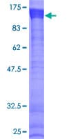 Human MEX3B / RKHD3 Protein (Recombinant GST)