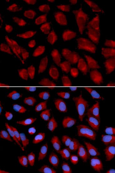 Polyclonal Rabbit anti-Human AIFM1 / AIF / PDCD8 Antibody (IHC, IF, WB)