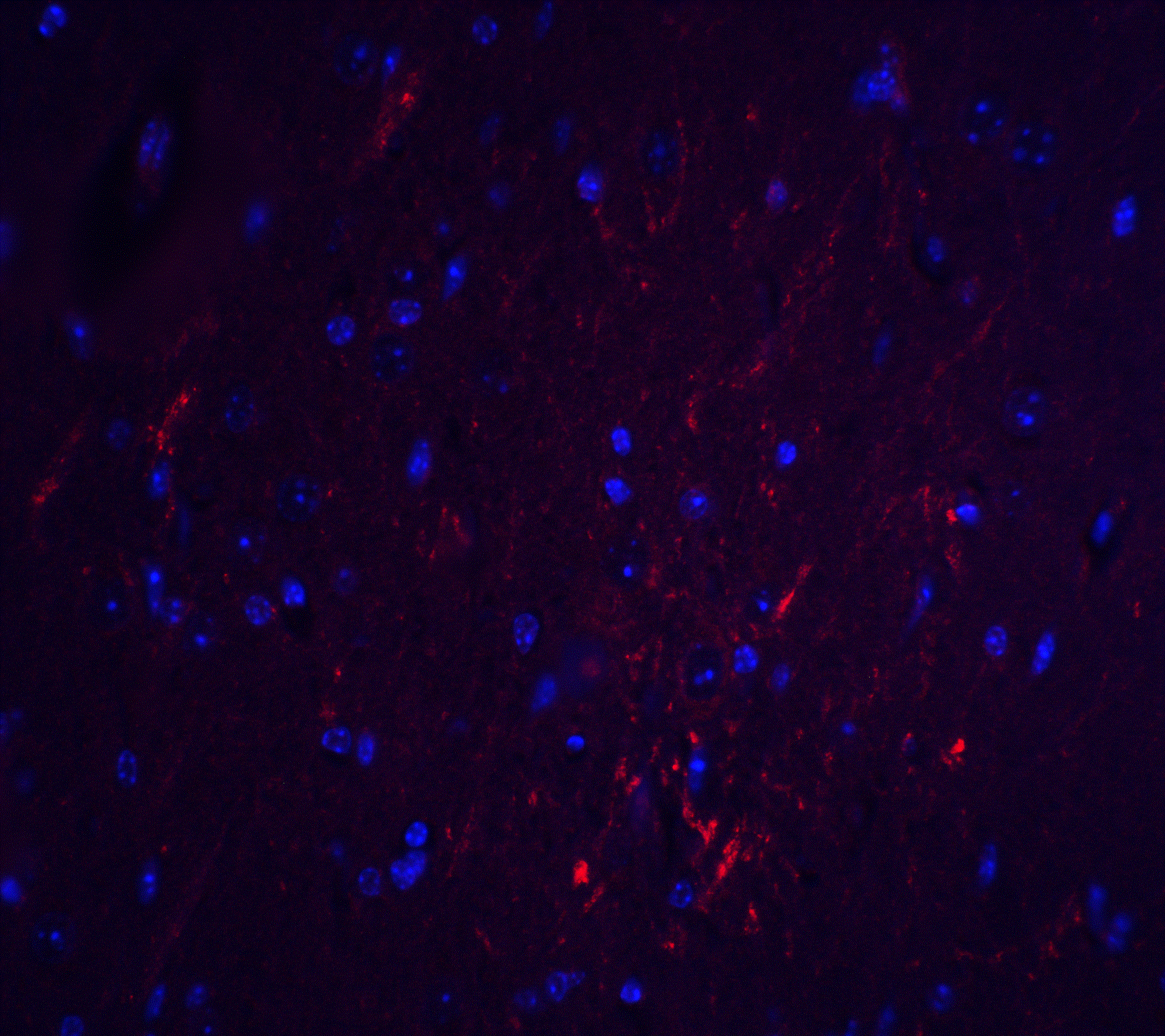 SIPR2 / S1P2 / EDG5 Antibody