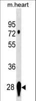 IHC-plus™ CAPNS2 Antibody (aa55-83)