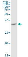 VDAC2 Antibody (clone 3D2)