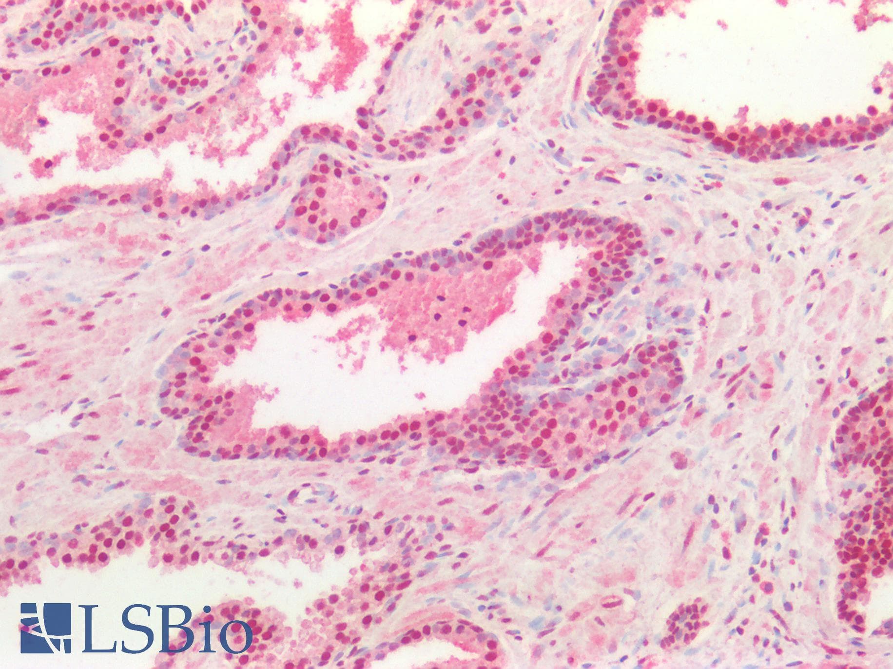 PathPlus™ TDP-43 / TARDBP Antibody (aa140-153)