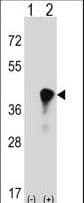 Polyclonal Rabbit anti-Human C4BPB / C4BP Beta Antibody (aa125-153, WB)