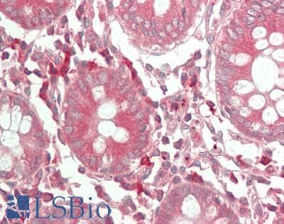 IHC-plus™ PSAP / Prosaposin Antibody (aa307-356)