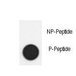 SMAD2 Antibody (phospho-Ser118)