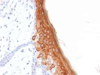 Recombinant Monoclonal Mouse anti-Human KRT10 / CK10 / Cytokeratin 10 Antibody (clone rKRT10/844, IHC)