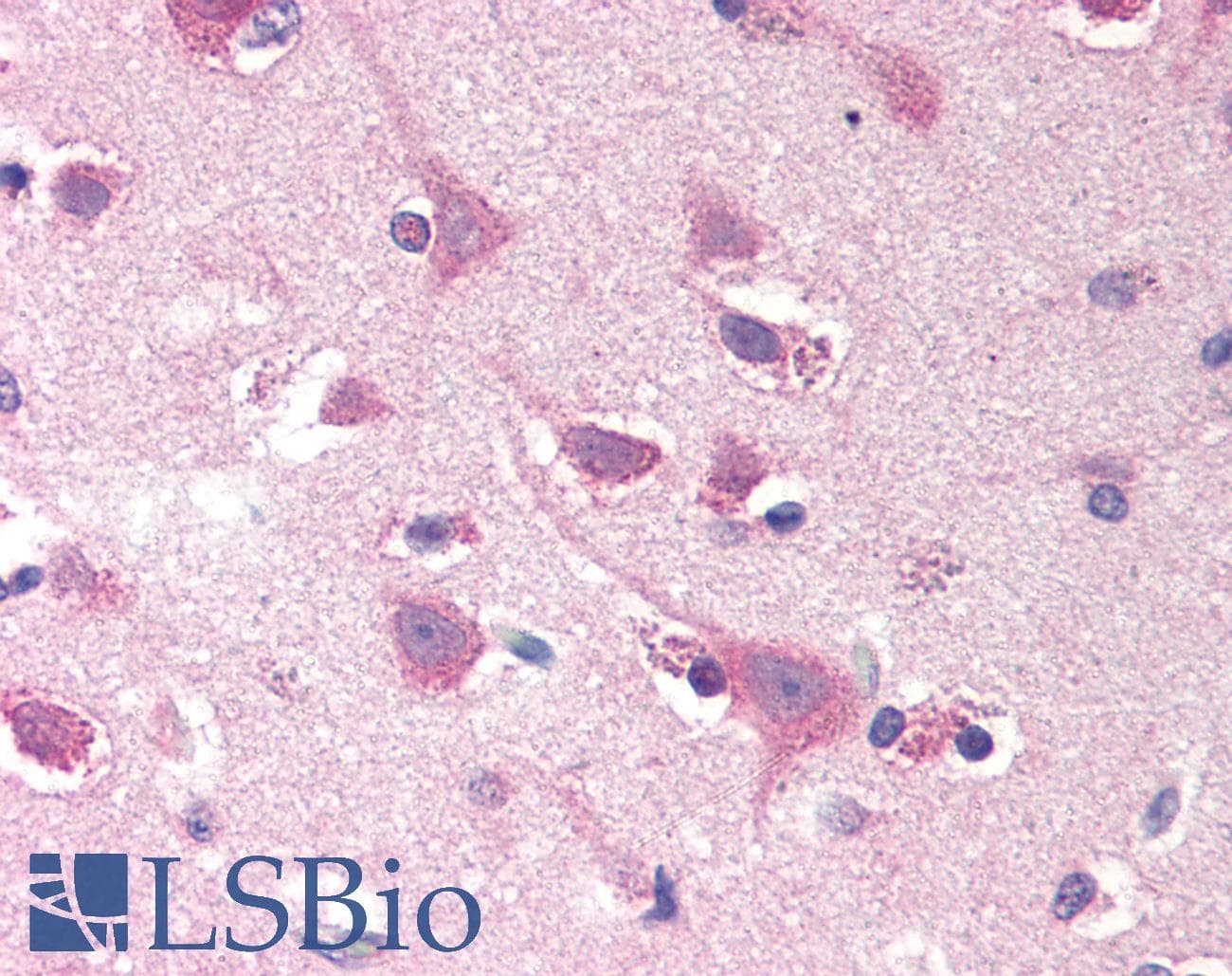 IHC-plus™ SMOC2 Antibody (N-Terminus)